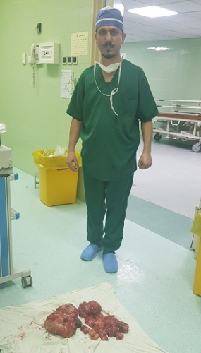 خروج توده ۷ کیلویی از شکم بیمار